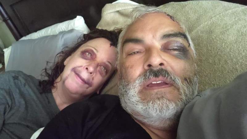 Pearland couple says they’re lucky to be alive after being attacked by burglar with a hammer